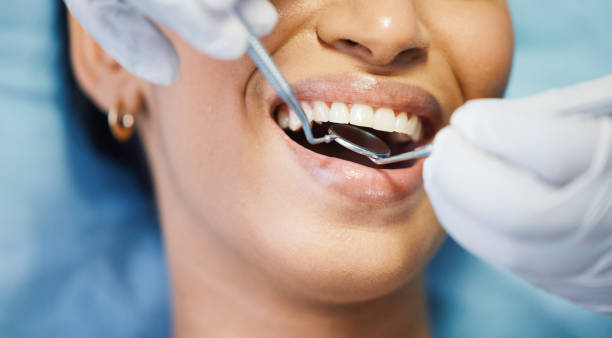 Best Walk-In Emergency Dentist in Englewood, OH